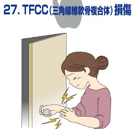 TFCC（三角線椎軟骨複合体）損傷