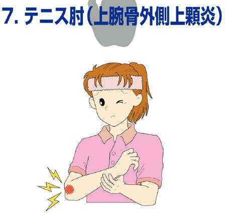 テニス肘（上腕骨外側上顆炎）