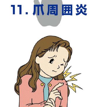 爪周囲炎