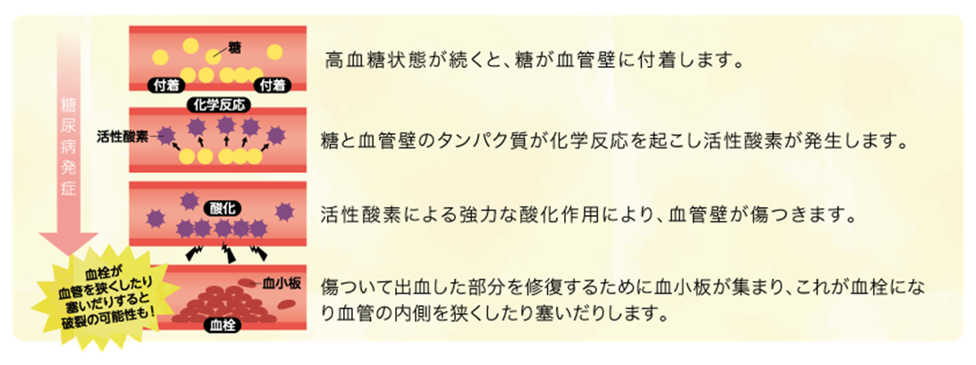合併症進行 合併症進行